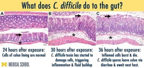 Effect of C Diff on gut cells